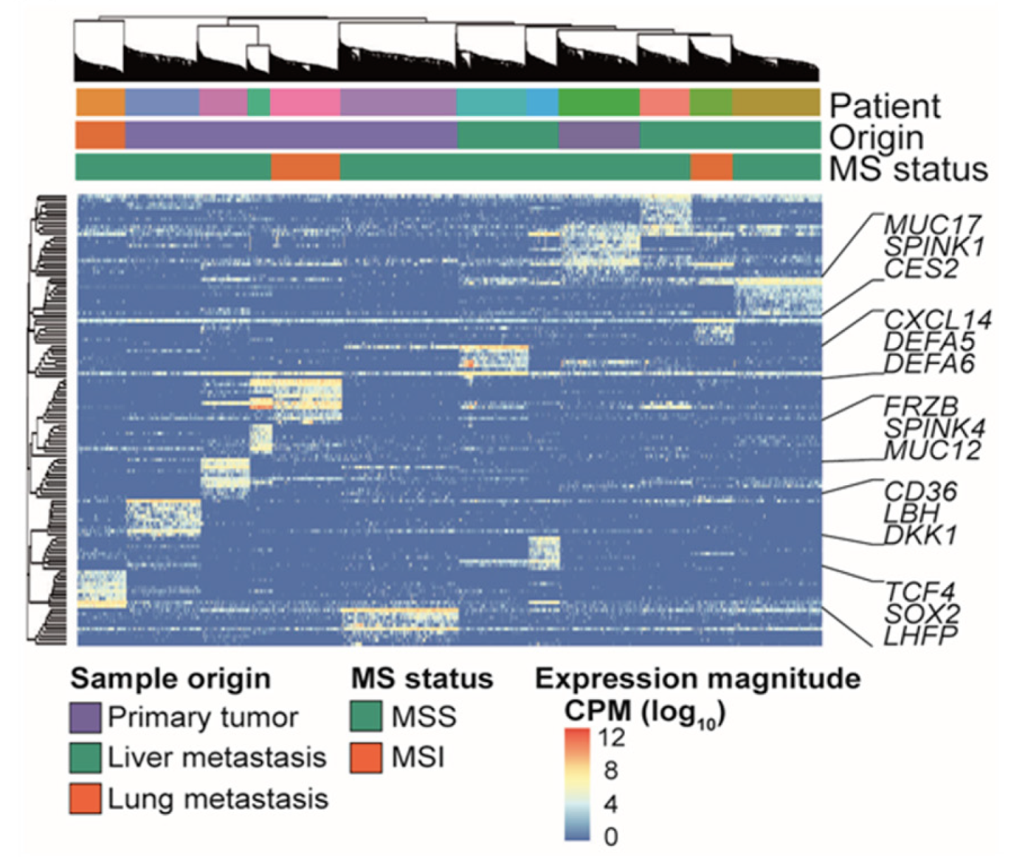 Functional States in Tumor-Initiating Cell Differentiation in Human Colorectal Cancer