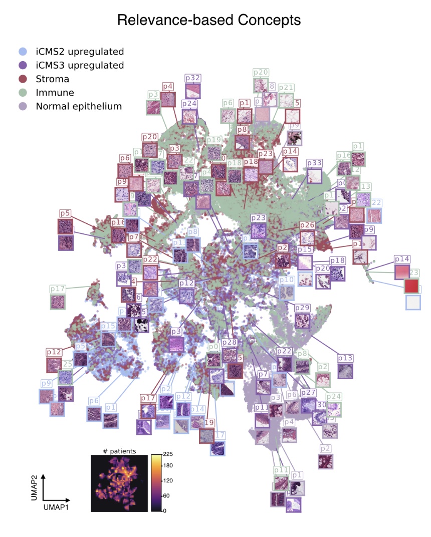 Concept-based explanation of gene expression prediction from H E images