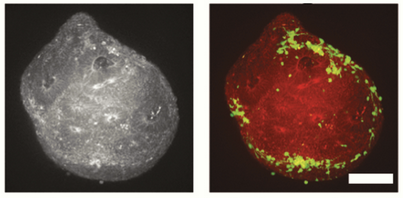 Modeling glioblastoma invasion using human brain organoids and single-cell transcriptomics